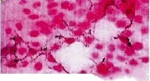Konutai Ascorbyl Phosphate Paura