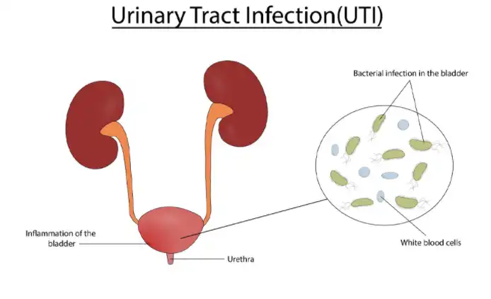 Nettle Root Extract Powder Nettle Root Extract Powder