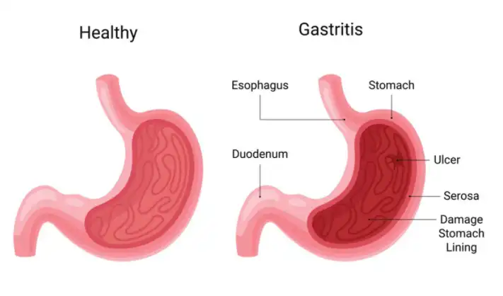Aloe Freeze-dried Powder
