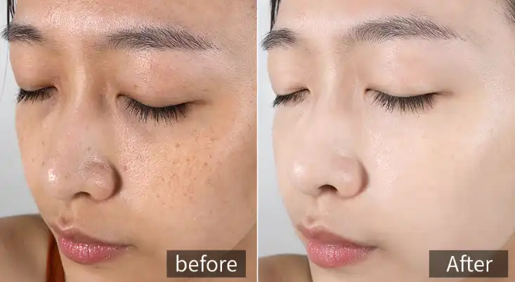 Hydrolyzed Pearl Powder Hydrolyzed Pearl Powder