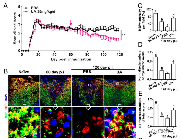 Ursolic acid Ursolic acid