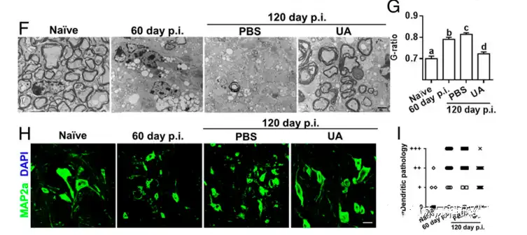 Ursolic acid Ursolic acid