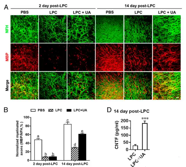 Ursolic acid Ursolic acid