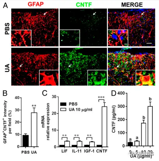 Ursolic acid Ursolic acid