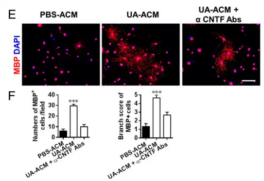 Ursolic acid Ursolic acid