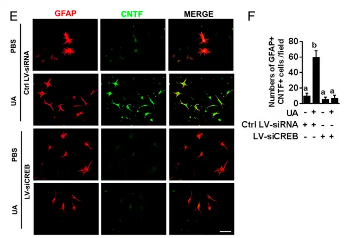 Ursolic acid Ursolic acid