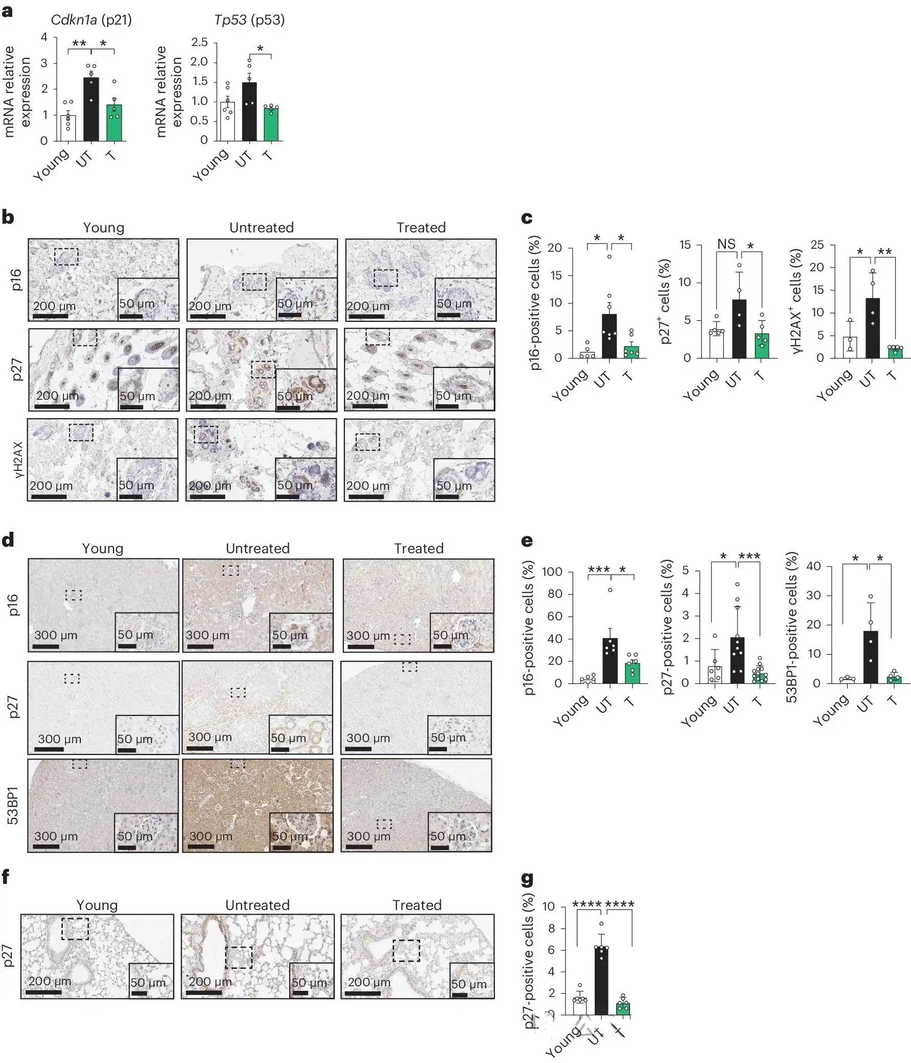 Sage extract powder Sage extract powder