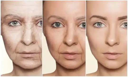 Pro-Xylane Pro-Xylane