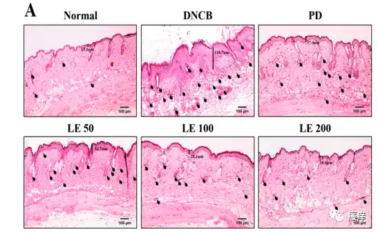 Lithospermum extract Lithospermum extract