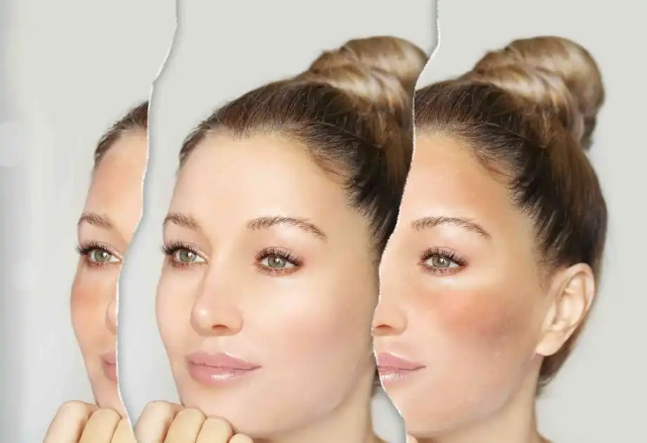 Vitamin C Ethyl Ether Vitamin C Ethyl Ether