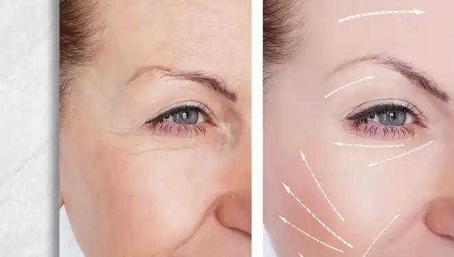 Bulk Aloe Extract Powder Bulk Aloe Extract Powder