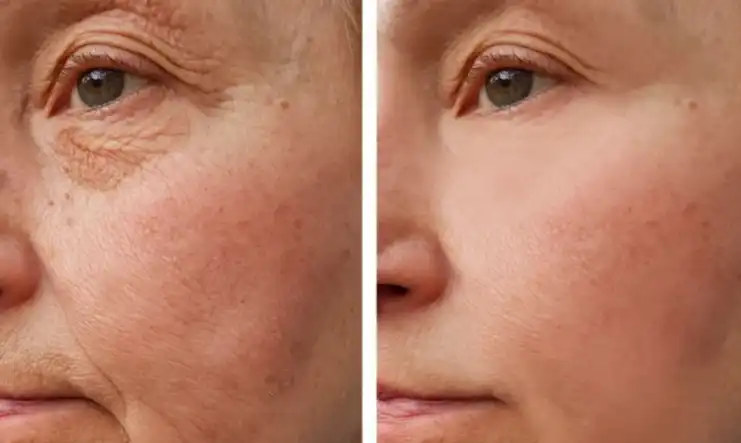 Pure Vitamin A Powder Pure Vitamin A Powder