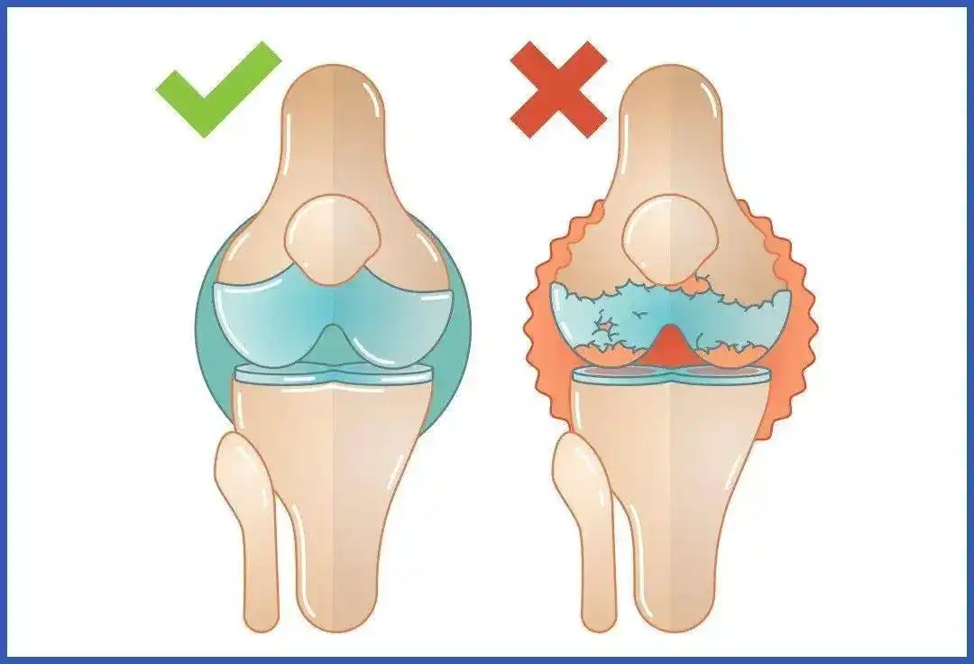 Chondroitin sulfate powder Chondroitin sulfate powder