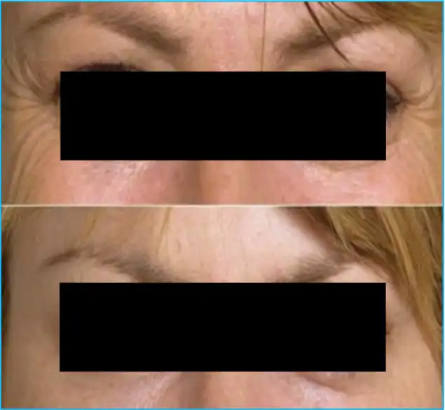 Snake venom peptide Snake venom peptide