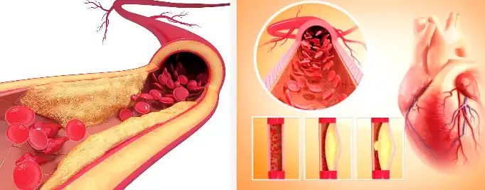 Betanin Powder Betanin Powder