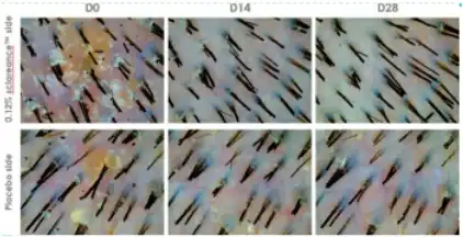 Sclarea lactone powder Sclarea lactone powder