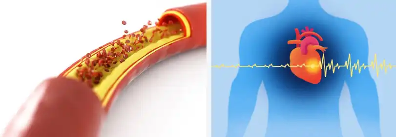 Berberine hydrochloride powder Berberine hydrochloride powder