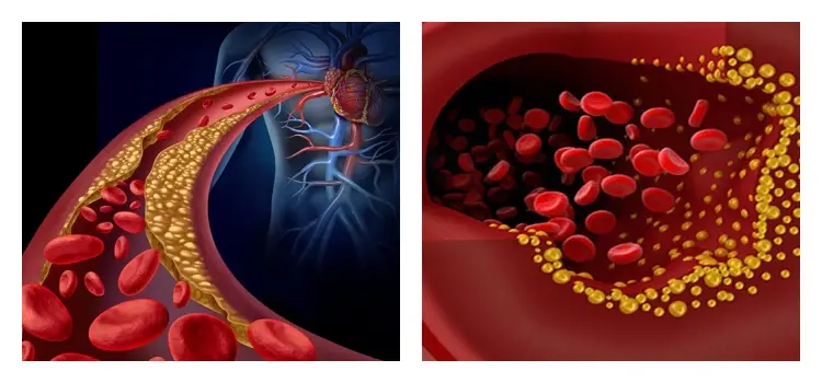 product-1-1 product-1-1