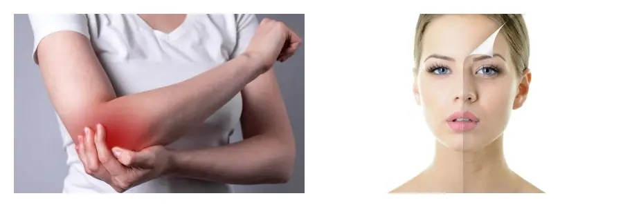 Horse Chestnut Extract Horse Chestnut Extract