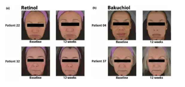 Psoralea Corylifolia Extract Psoralea Corylifolia Extract