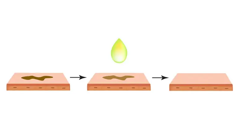 tranexamic acid powder tranexamic acid powder