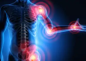 Thymoquinone Thymoquinone