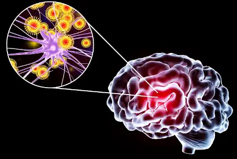Thymoquinone Thymoquinone