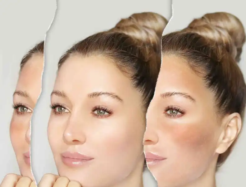 Thiamidol Powder Thiamidol Powder