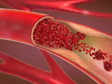 Foti Extract Foti Extract