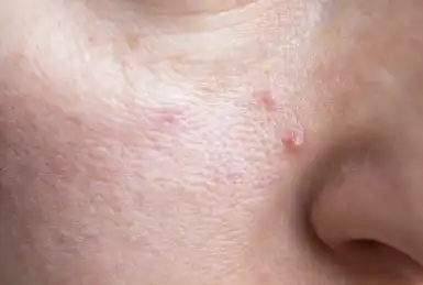 Diammonium Glycyrrhizinate Diammonium Glycyrrhizinate