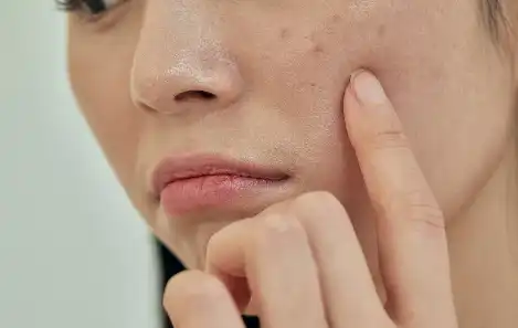 Diammonium Glycyrrhizinate Diammonium Glycyrrhizinate