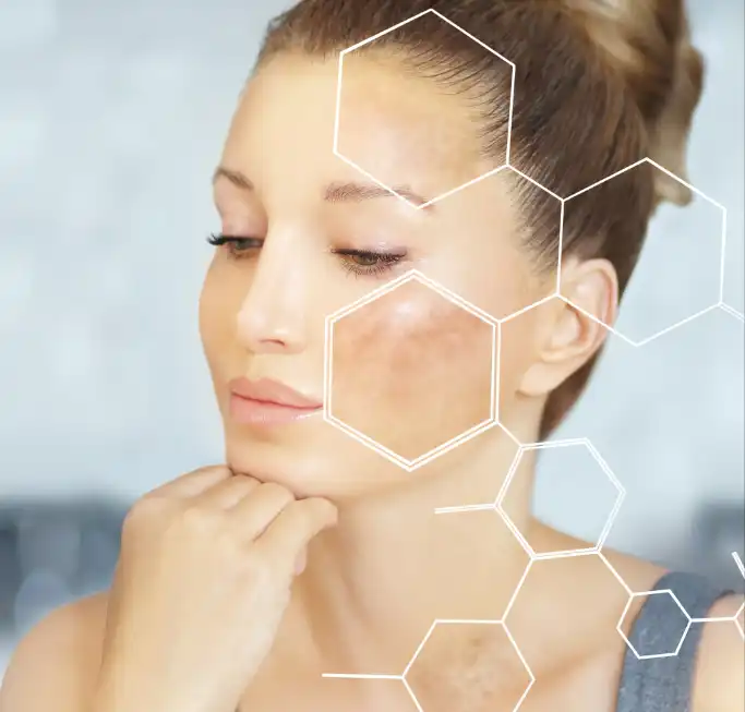 Glucosylglycerol Glucosylglycerol