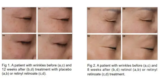 Retinyl Retinoate Powder