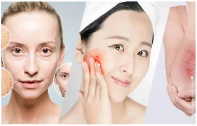 PDRN Powder PDRN Powder