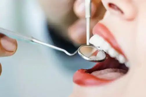 Isomaltulose Isomaltulose