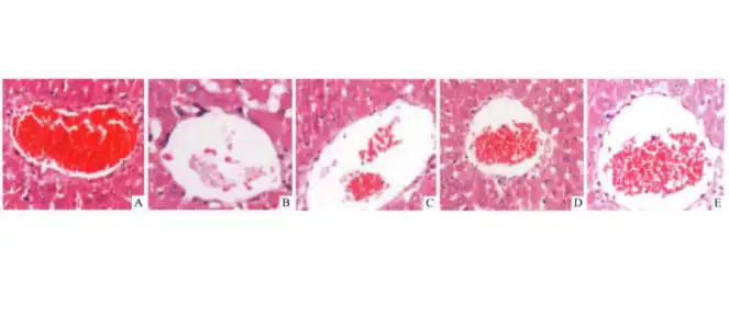 Silybin Powder Silybin Powder