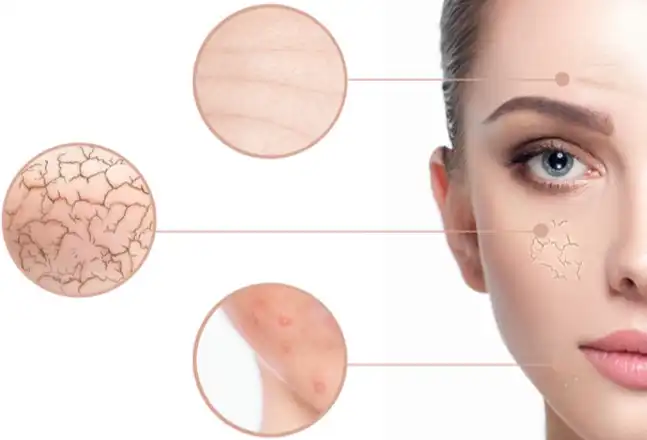 Sodium Ascorbyl Phosphate Sodium Ascorbyl Phosphate