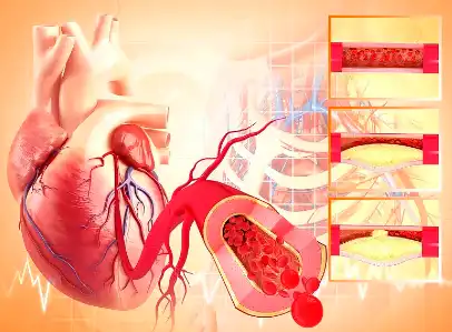 Citrus Flavonoids Citrus Flavonoids