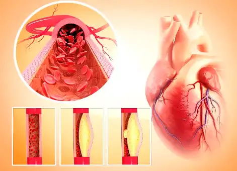 PQQ Powder PQQ Powder