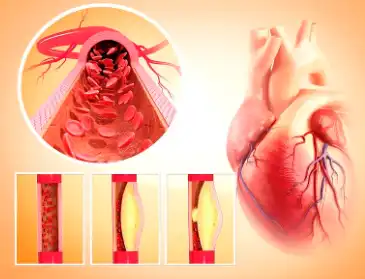 Green Lipped Mussel Freeze-Dried Powder Green Lipped Mussel Freeze-Dried Powder