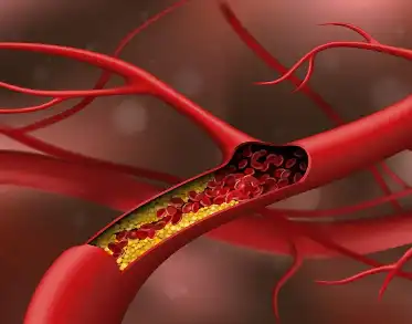 Blueberry Fruit Juice Powder Blueberry Fruit Juice Powder