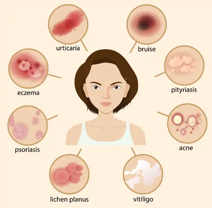 Diammonium Glycyrrhizinate Diammonium Glycyrrhizinate
