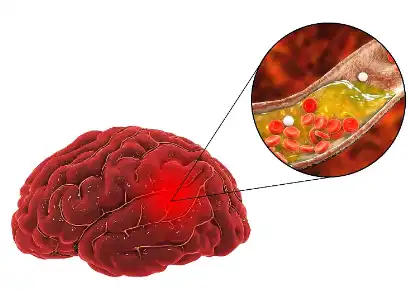 Soy Phytosterols Soy Phytosterols