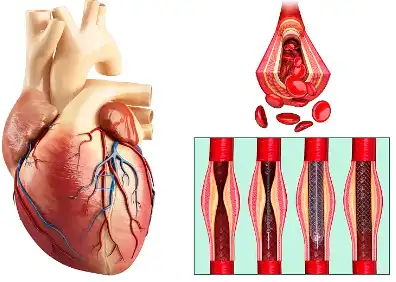 Buddleoside Buddleoside