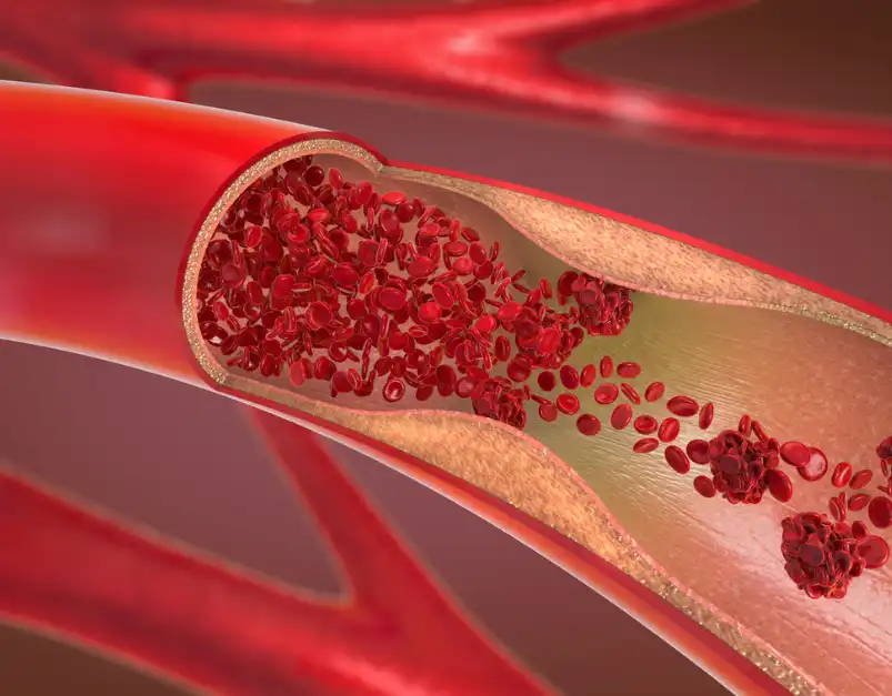 Nattokinase Nattokinase