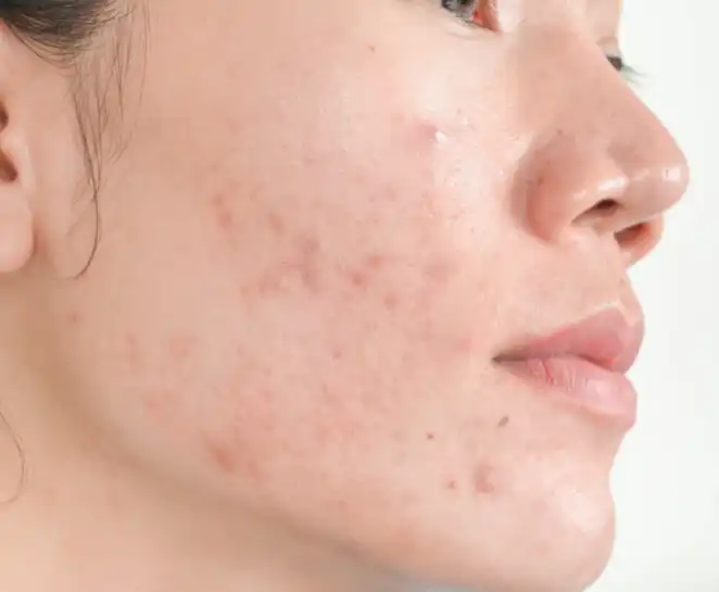 zinc gluconate zinc gluconate