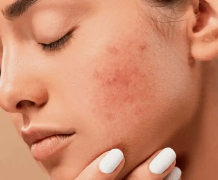 Bulk Potassium Iodide Bulk Potassium Iodide