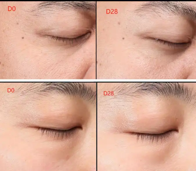 Acetyl Hexapeptide-38 Acetyl Hexapeptide-38