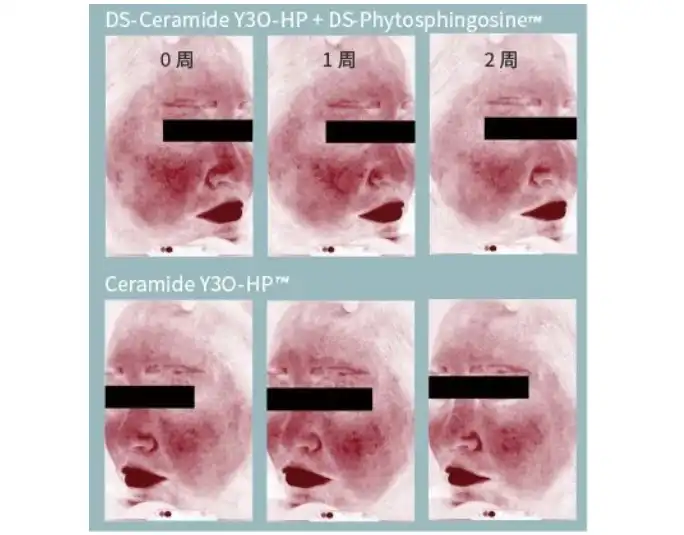 Phytosphingosine Phytosphingosine