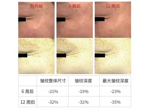 Phytosphingosine Phytosphingosine